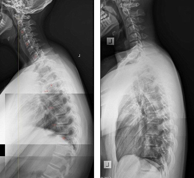 Rendgenske snimke doktora Jamesa Cartera