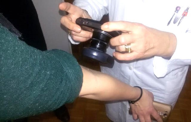Dermatoskop, Liga protiv raka