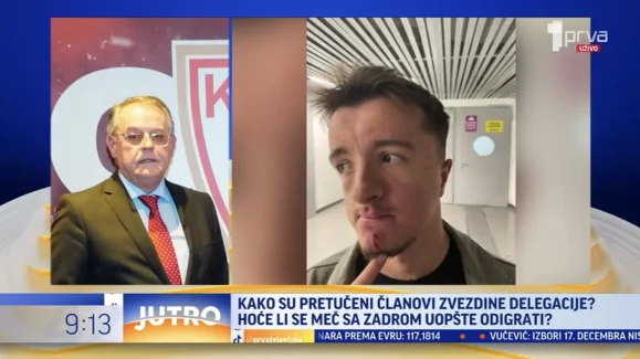 ozlijede zvezdasa 1