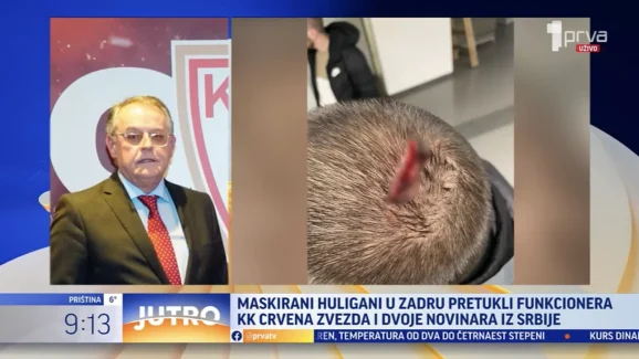 ozlijede zvezdasa 3